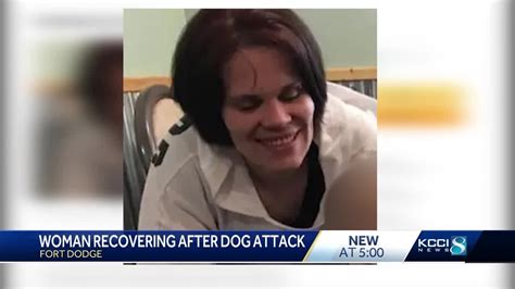 brittany skoland dog attack|fort dodge pit bull attack.